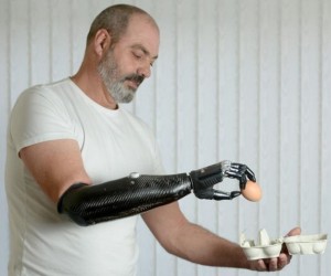 robotic-bionic-prosthetic-arm